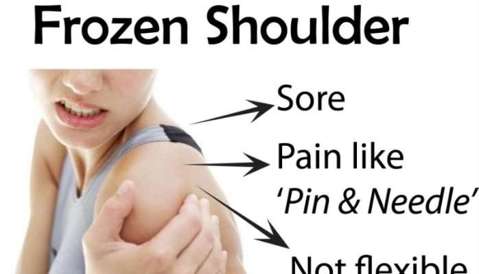 Sweet Route and Frozen Shoulders